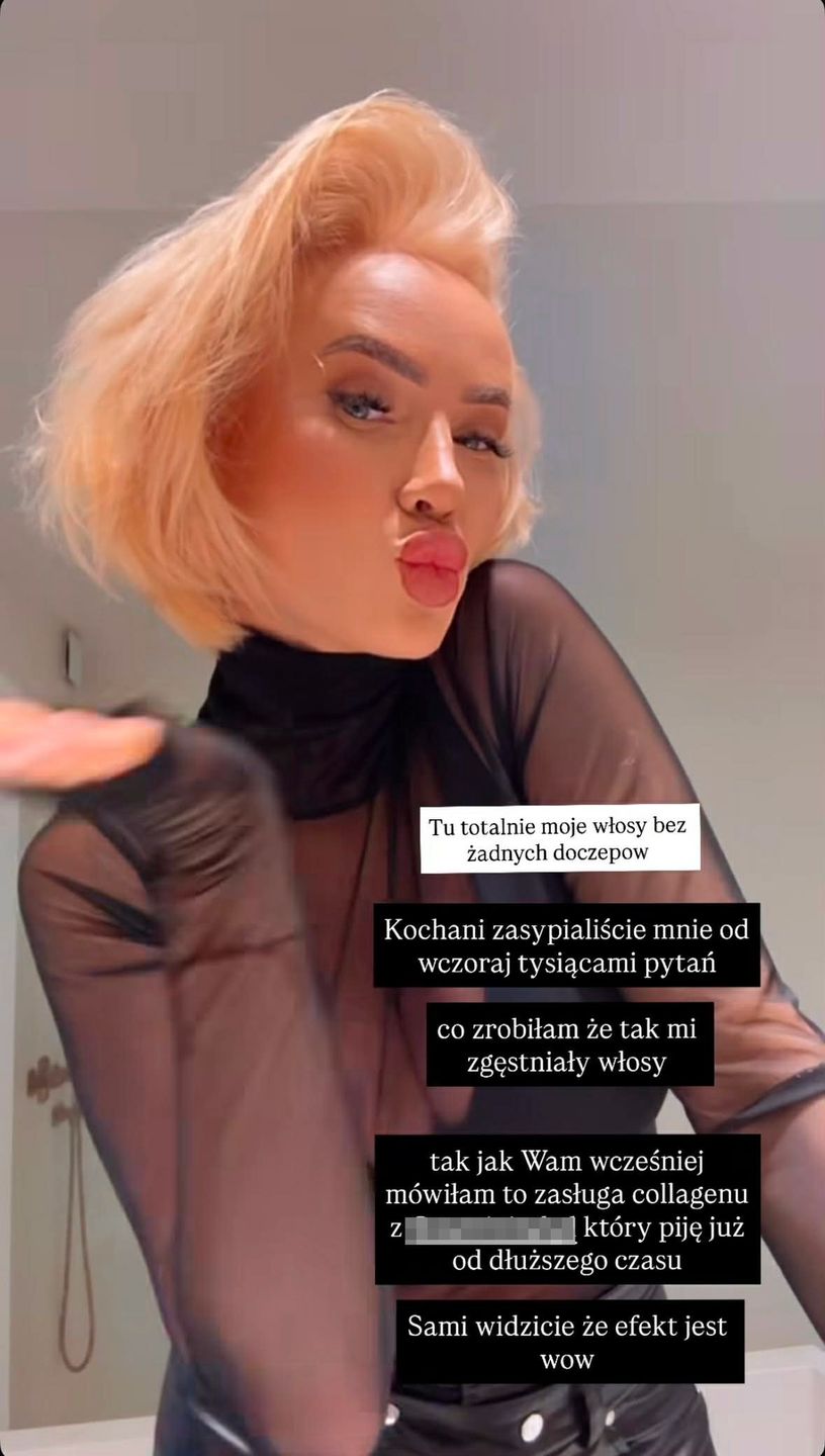 Izabela Macudzińska pokazała się bez doczepów