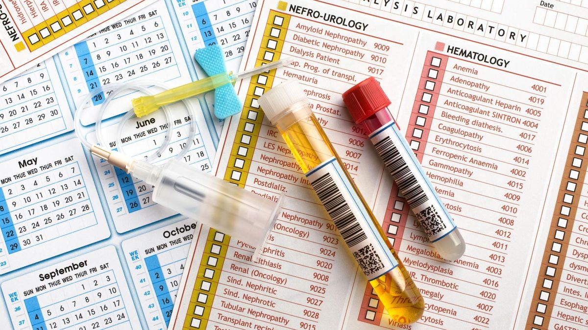 Poziom homocysteiny podnosi się w przebiegu niektórych chorób