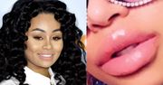 Blac Chyna chwali się monstrualnymi wargami. Internauci: "OBRZYDLIWE. Nigdy nie będziesz miała klasy!"