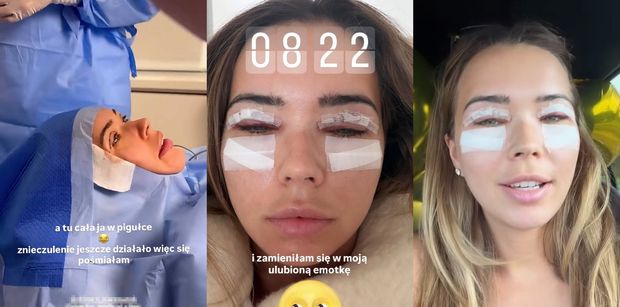 Sandra Kubicka pokazała się PO OPERACJI i ZAPEWNIA, że NIE MAJSTROWAŁA przy dolnych powiekach. "Zaczynają dziać się jakieś spekulacje" (ZDJĘCIA)