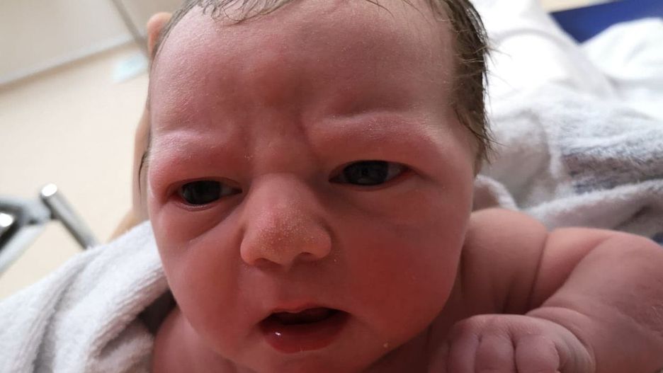 Kiedy się urodził, mama nie mogła uwierzyć własnym oczom. Dziecko wyglądało na wściekłe