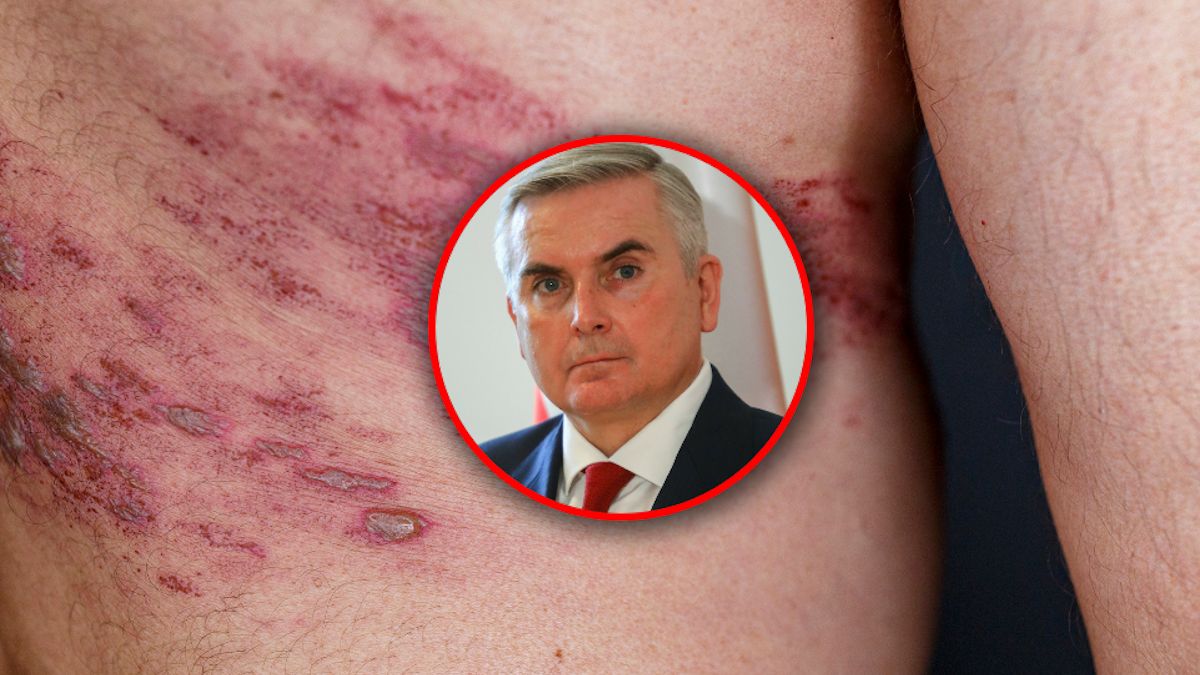 Nowe bezpłatne szczepienia. Jest decyzja Ministerstwa Zdrowia.