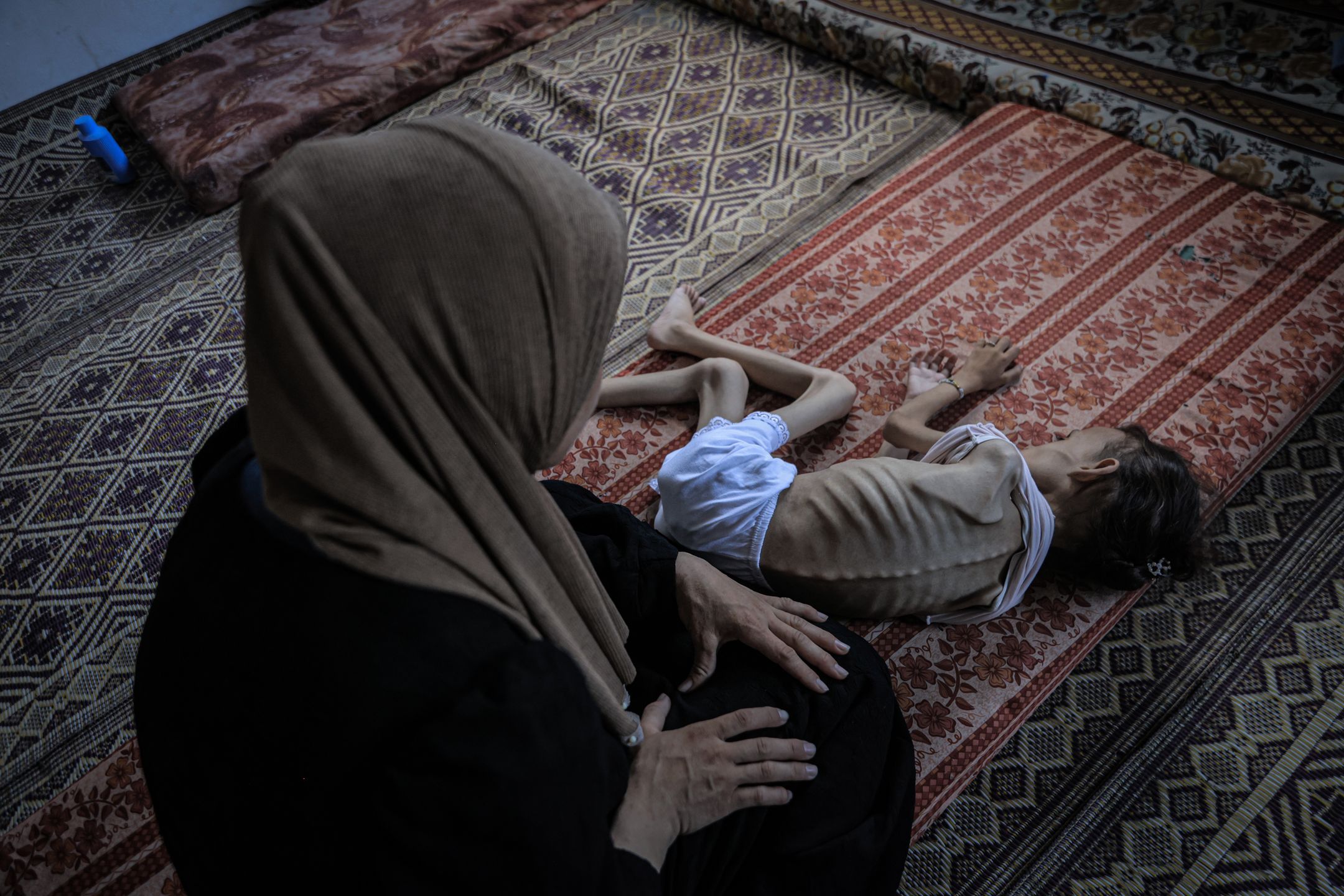 9-letnia palestyńska dziewczynka nie może już chodzić