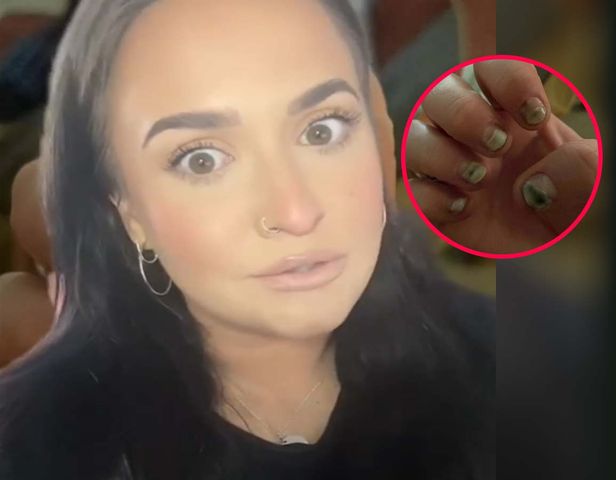 Jej paznokcie zrobiły się czarne