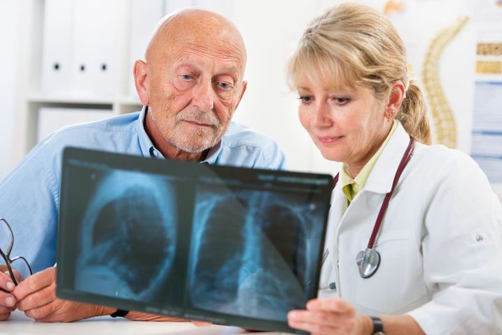 Na zaplenie płuc często zapadają osoby starsze