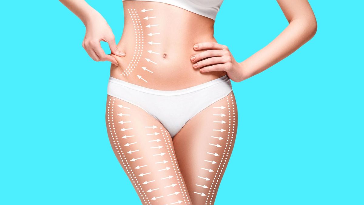 Lipoliza iniekcyjna – kiedy warto zdecydować się na zabieg?