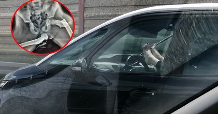 Trzymasz tak nogi w aucie? Wygoda może skończyć się tragicznie