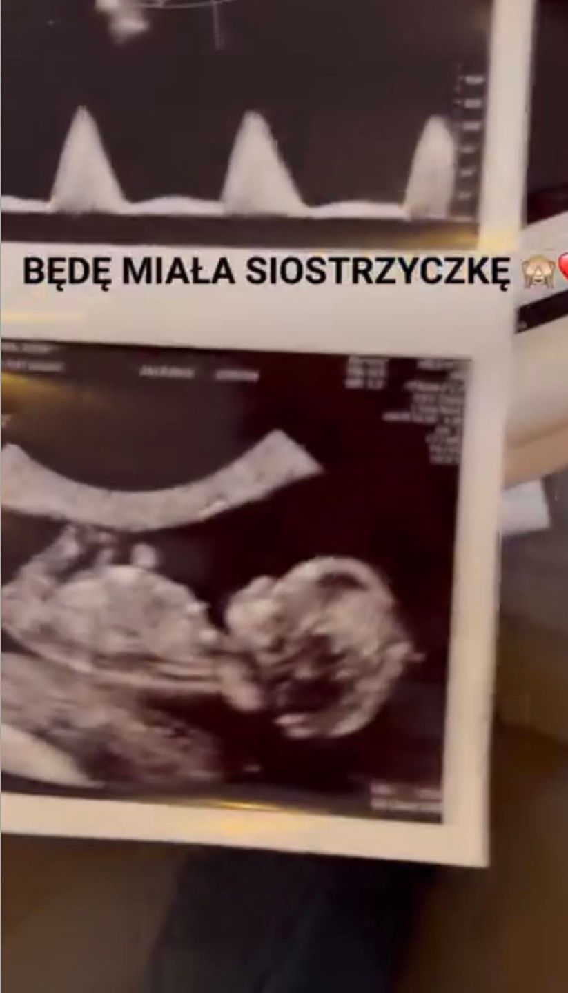 Zofia Zborowska ogłasza ciążę