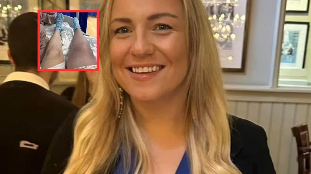 "Covidowa noga" była dla niej zagrożeniem. Na nic zdał się nawet aktywny tryb życia