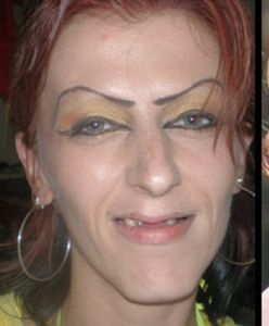 Chciała tylko poprawić urodę. Program odmienił jej życie