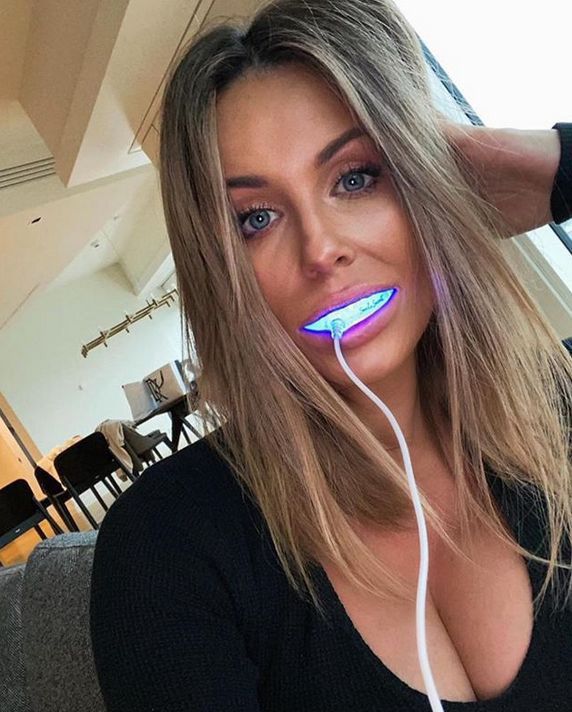 Małgorzata Rozenek reklamuje nakładki na zęby
