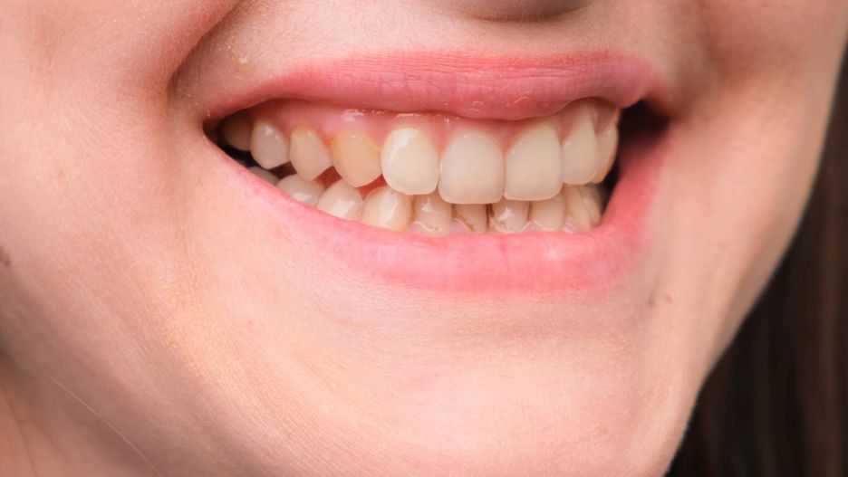 Dentysta zdradził, jak uniknąć żółtych zębów