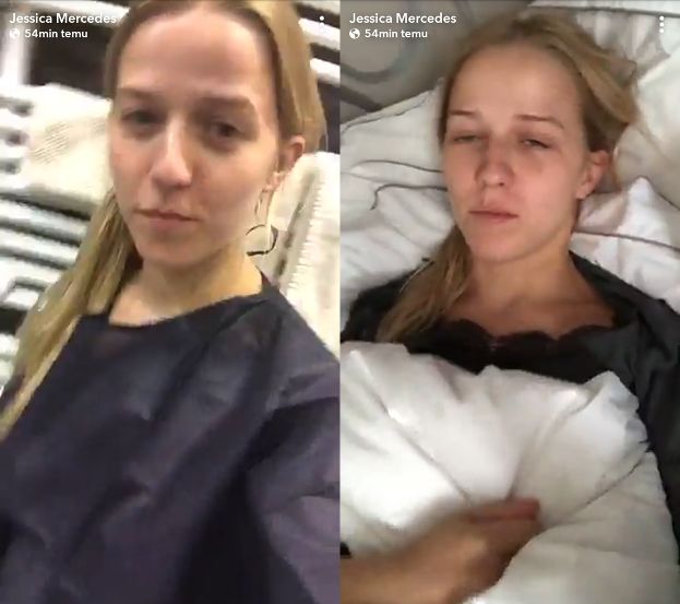 ŻENADA ROKU? Jessica Mercedes relacjonuje operację żuchwy na Instagramie: "Takie tam połamanie i pocięcie twarzy!"