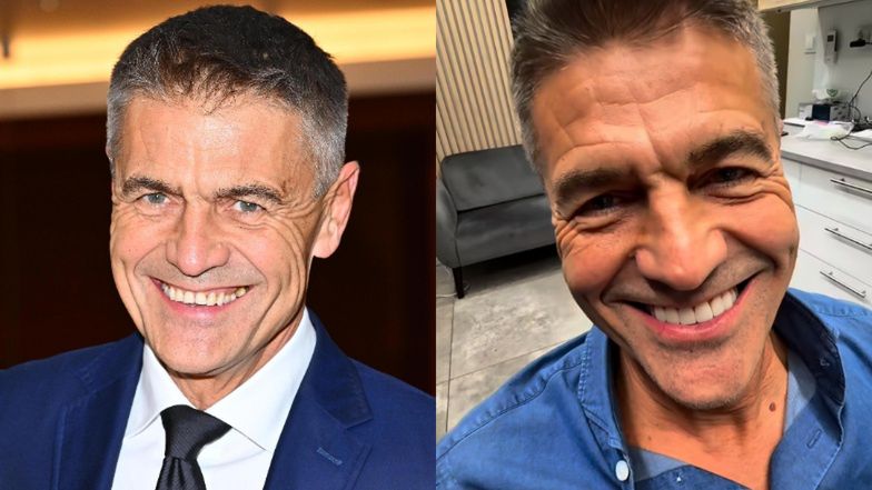 Krzysztof Hołowczyc sprawił sobie nowe zęby