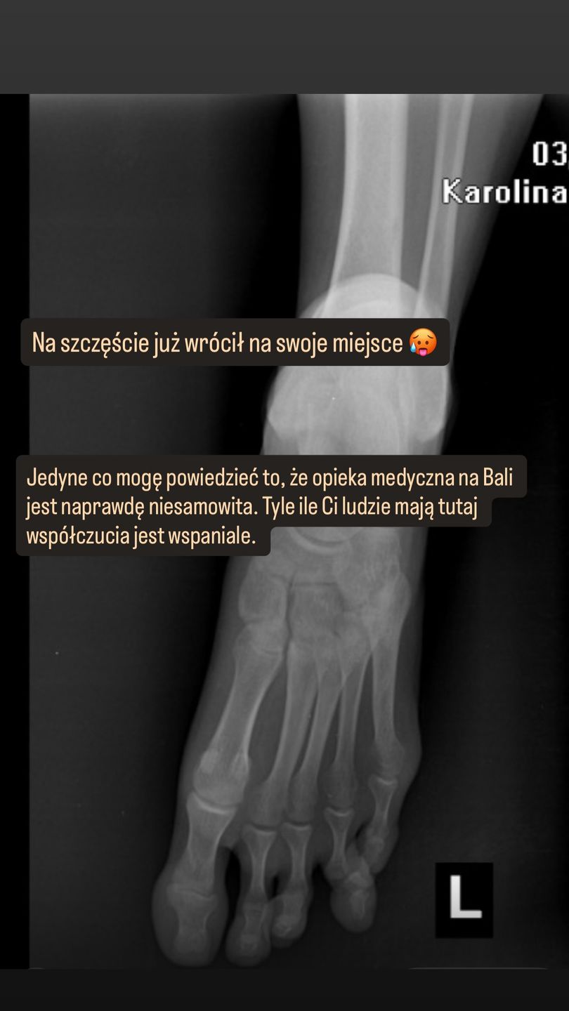 Żona Piotra Adamczyka uległa wypadkowi