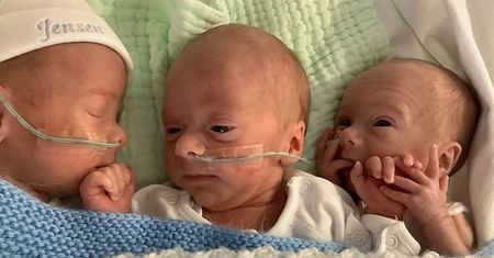 Trojaczki jednojajowe dzieliły jedno łożysko. "Takie dzieci rodzą się raz na 200 milionów"