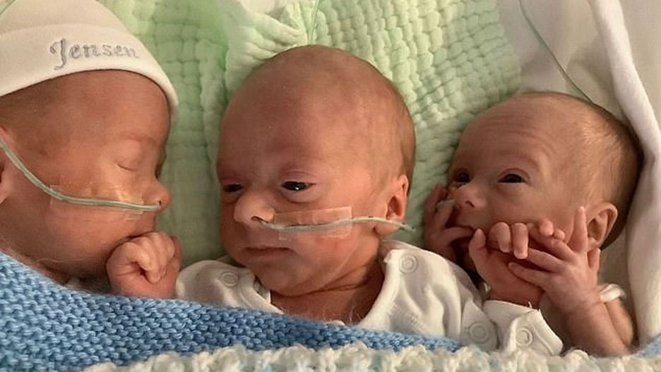 Trojaczki jednojajowe dzieliły jedno łożysko. "Takie dzieci rodzą się raz na 200 milionów"