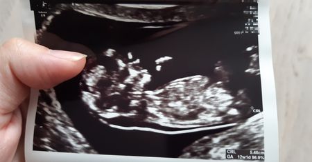 "Jestem jedną z ostatnich kobiet, które miały legalną aborcję". Tak wygląda zabieg