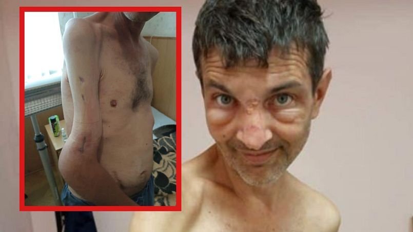 Więziony przez Rosjan Mychajło Dianow teraz chce pomóc innym ofiarom wojny