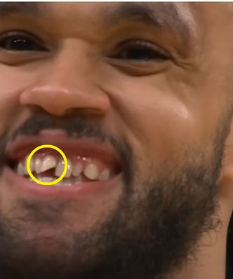 Stracił zęba. Ale jest mistrzem NBA. "Oddałbym wszystkie"