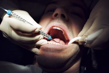 Turystyka dentystyczna Polaków. Tu jeżdżą po plomby za 50 zł