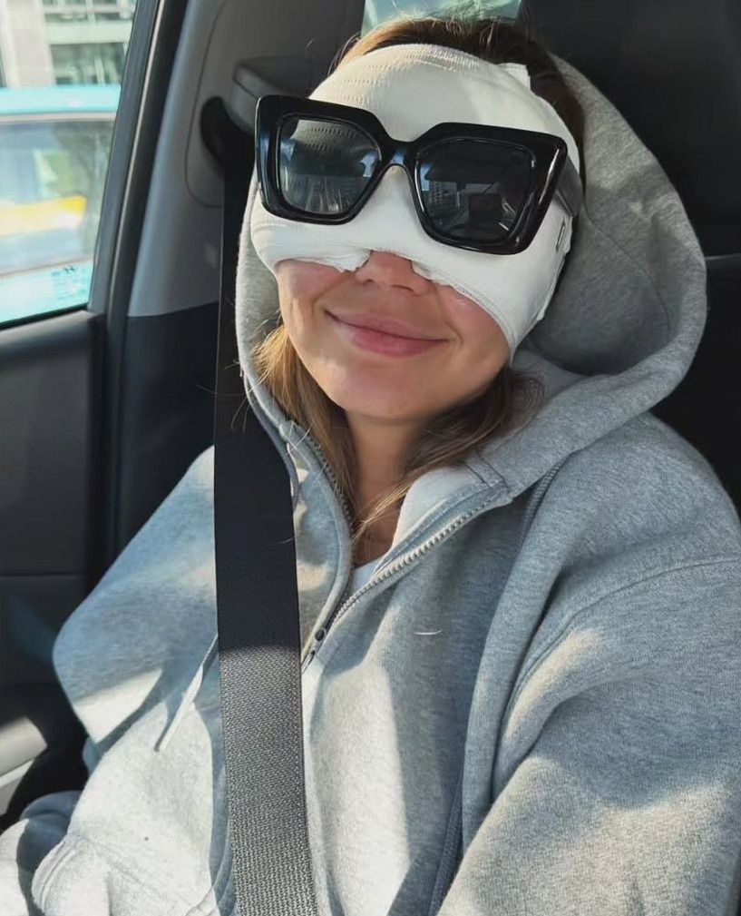 Sandra Kubicka po operacji powiek