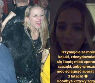 Zmiany u Jessiki Mercedes: "Goodbye krzywy zgryz!"