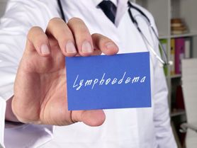 Obrzęk limfatyczny – przyczyny, objawy i leczenie