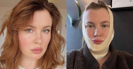 Córka Aleca Baldwina tłumaczy się z "modelowania" podbródka: "Miałam nieznośną KIESZEŃ TŁUSZCZU"