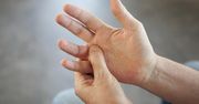 Czujesz mrowienie w dłoniach? Znak, że brakuje ci ważnej witaminy