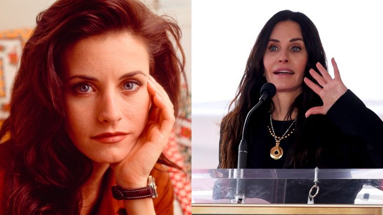 Te gwiazdy pożałowały operacji plastycznych