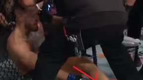 Pokazano zdjęcia nogi. Tragedia Conora McGregora w oktagonie UFC