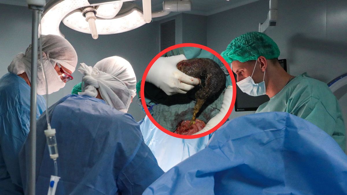 10-latka z Indii trafiła na stół operacyjny