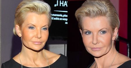 Twarz Racewicz zaczyna wyglądać normalnie? (ZDJĘCIA)