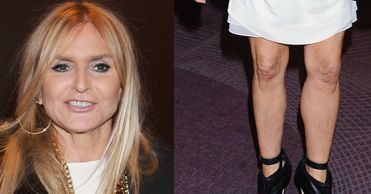 Monika Olejnik pokazała niedoskonałe nogi