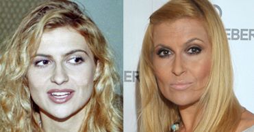 Katarzyna Skrzynecka: Kiedyś była taka piękna...