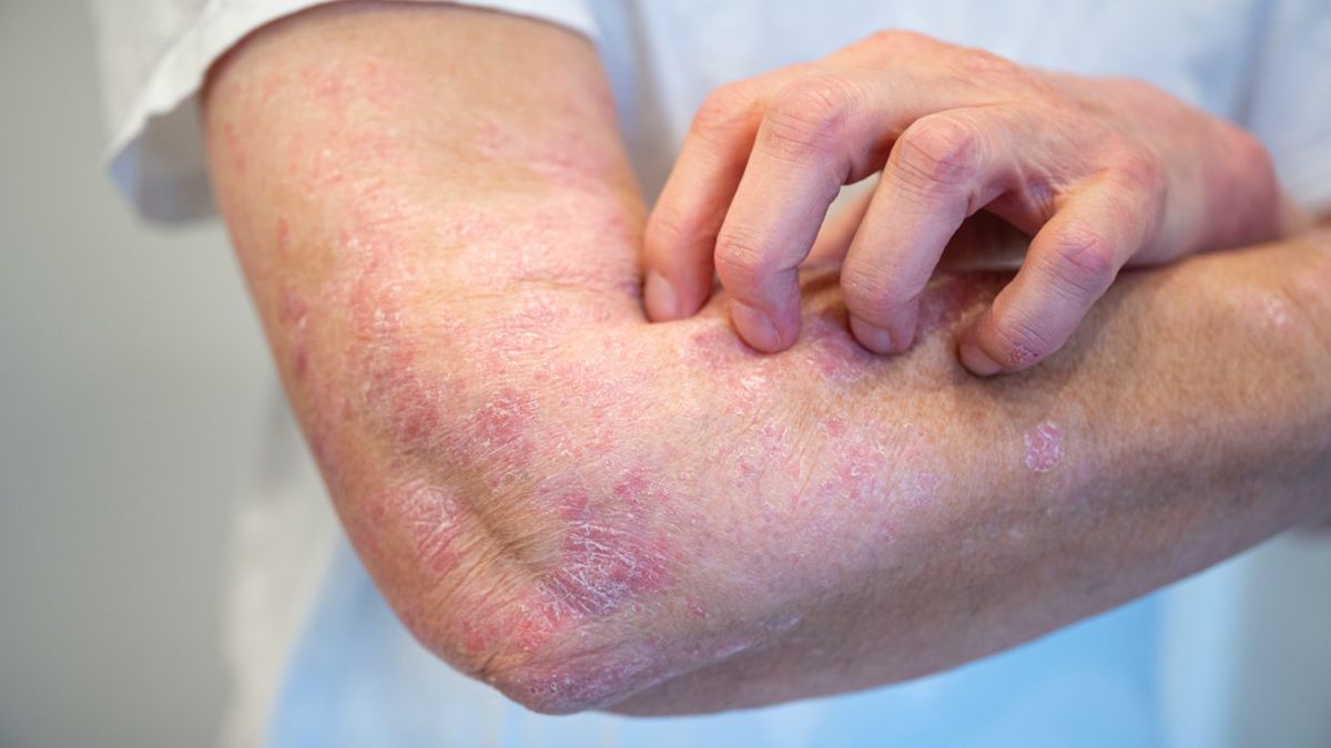 Afloderm maść to środek przeznaczony do stosowania na skórę.