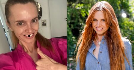 Katarzyna Burzyńska tłumaczy się z "utraty zębów" na antenie TVP. "Jestem dziewczyną bez zęba na przedzie" (FOTO)