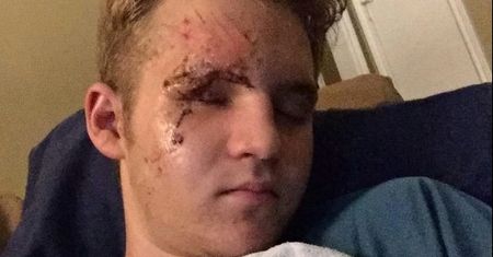 "American Horror Story": Dalton Gray cudem uniknął śmierci