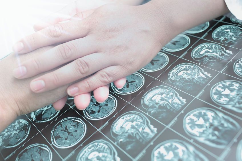 Diagnostyka obrazowa jest bardzo ważna określeniu pochodzenia nowotworów