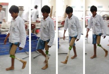 Student skonstruował protezę kolana za 20 USD