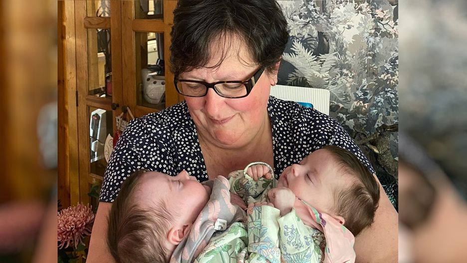 Urodziły się ze wspólną wątrobą, jelitem i nogą