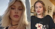 Modelka została brutalnie pobita w Dubaju. Ujawniła drastyczne szczegóły napaści