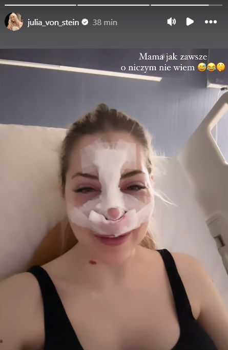 Julia von Stein po operacji nosa