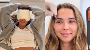Sandra Kubicka zaprezentowała się fanom po ściągnięciu szwów: "Wyglądam jeszcze jak dzwonnik z Notre Dame" (FOTO)