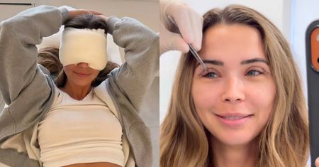Sandra Kubicka zaprezentowała się fanom po ściągnięciu szwów: "Wyglądam jeszcze jak dzwonnik z Notre Dame" (FOTO)