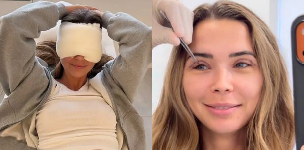 Sandra Kubicka zaprezentowała się fanom po ściągnięciu szwów: "Wyglądam jeszcze jak dzwonnik z Notre Dame" (FOTO)