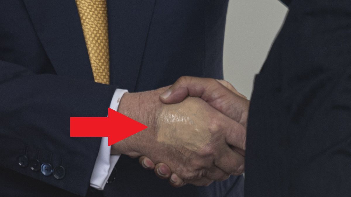 Media zwróciły uwagę na rękę Trumpa na konferencji.