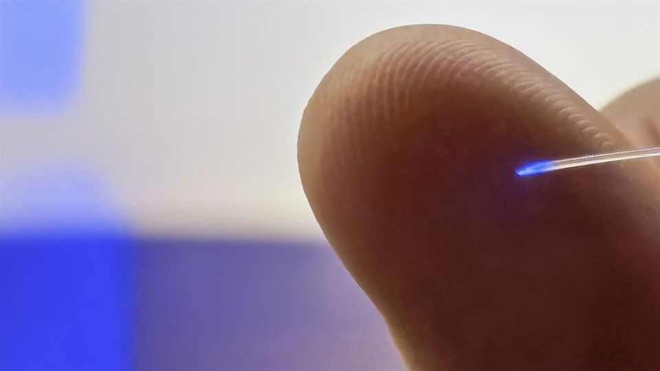 mAxialtrode - nowy implant do mózgu opracowany przez naukowców