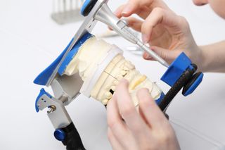 Objawy chorób żuchwy – choroby, diagnostyka, leczenie 